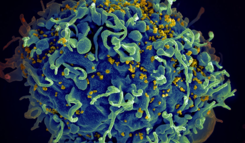 Scientists may have just discovered a breakthrough treatment for HIV