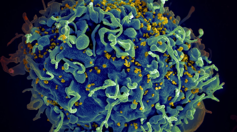 Scientists may have just discovered a breakthrough treatment for HIV