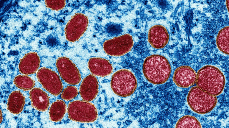 Why the response to the monkeypox outbreak is problematic