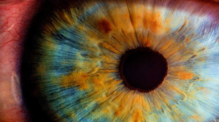 This eye implant could cure blindness for millions of people