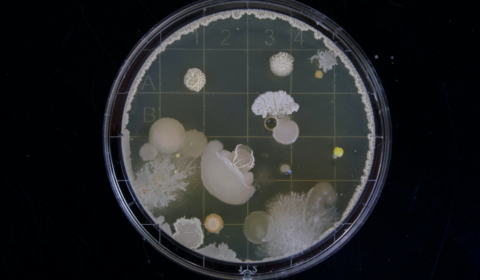 Pathogenic fungi could get stronger as the climate grows warmer