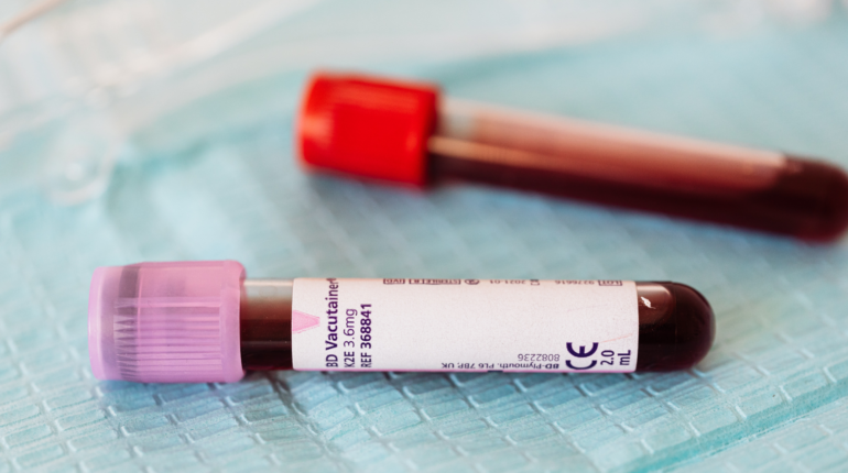 Limits on blood donations from gay and bisexual men eased by FDA