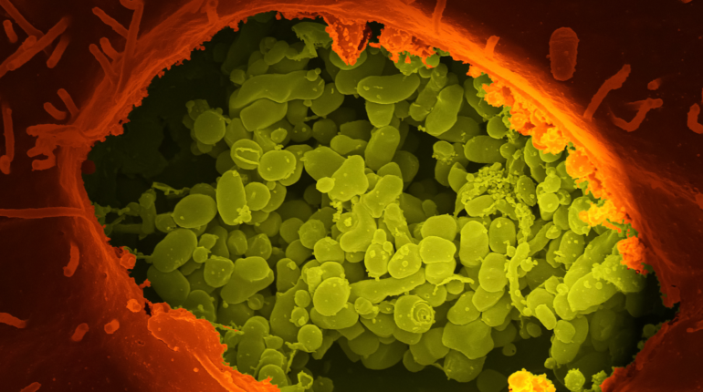 Bacteria is now being used to create endlessly recyclable plastic