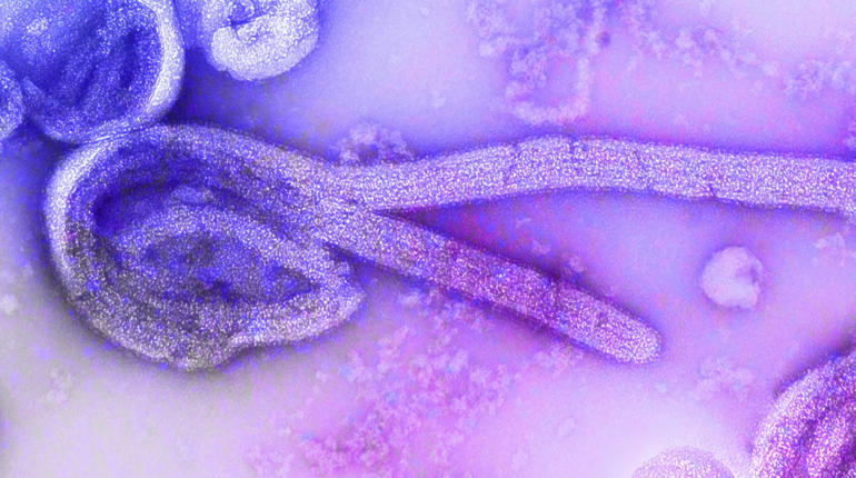 Are we prepared for the next pandemic?