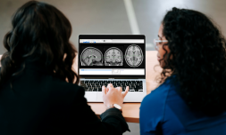 Cambridge brain study says adolescence may last into our 30s