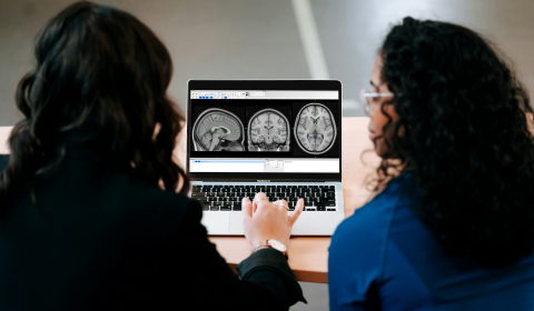 Cambridge brain study says adolescence may last into our 30s