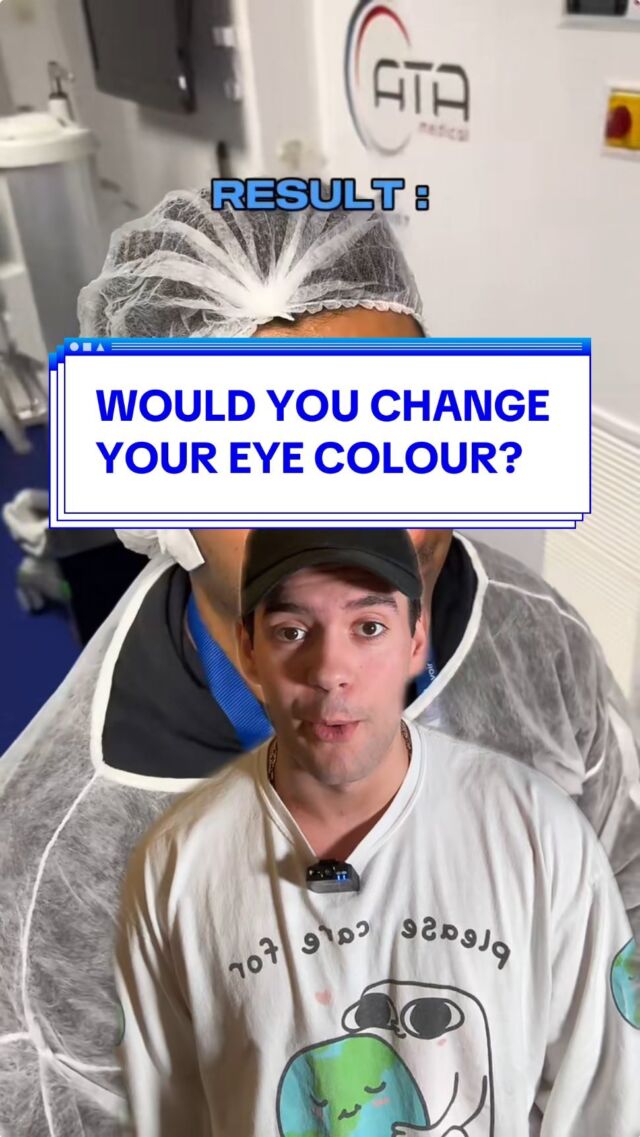 Eye colour transformations is apparently a thing now. Would you consider changing your eye colour? 👀

Share your thoughts in the comments below 👇

#newcolour #eyecolourchange #flaak #keratopigmentation #eyes #eye #ceratopigmentcao