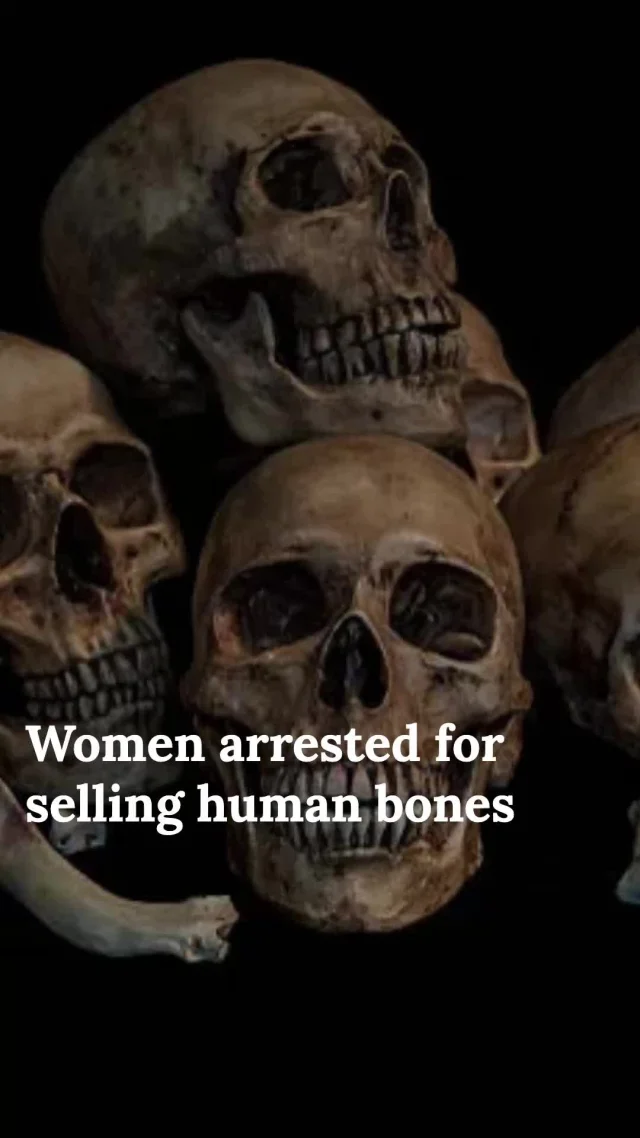 You won't believe what's been found on Facebook Marketplace! 💀 Two women in Florida caught selling REAL human bones!